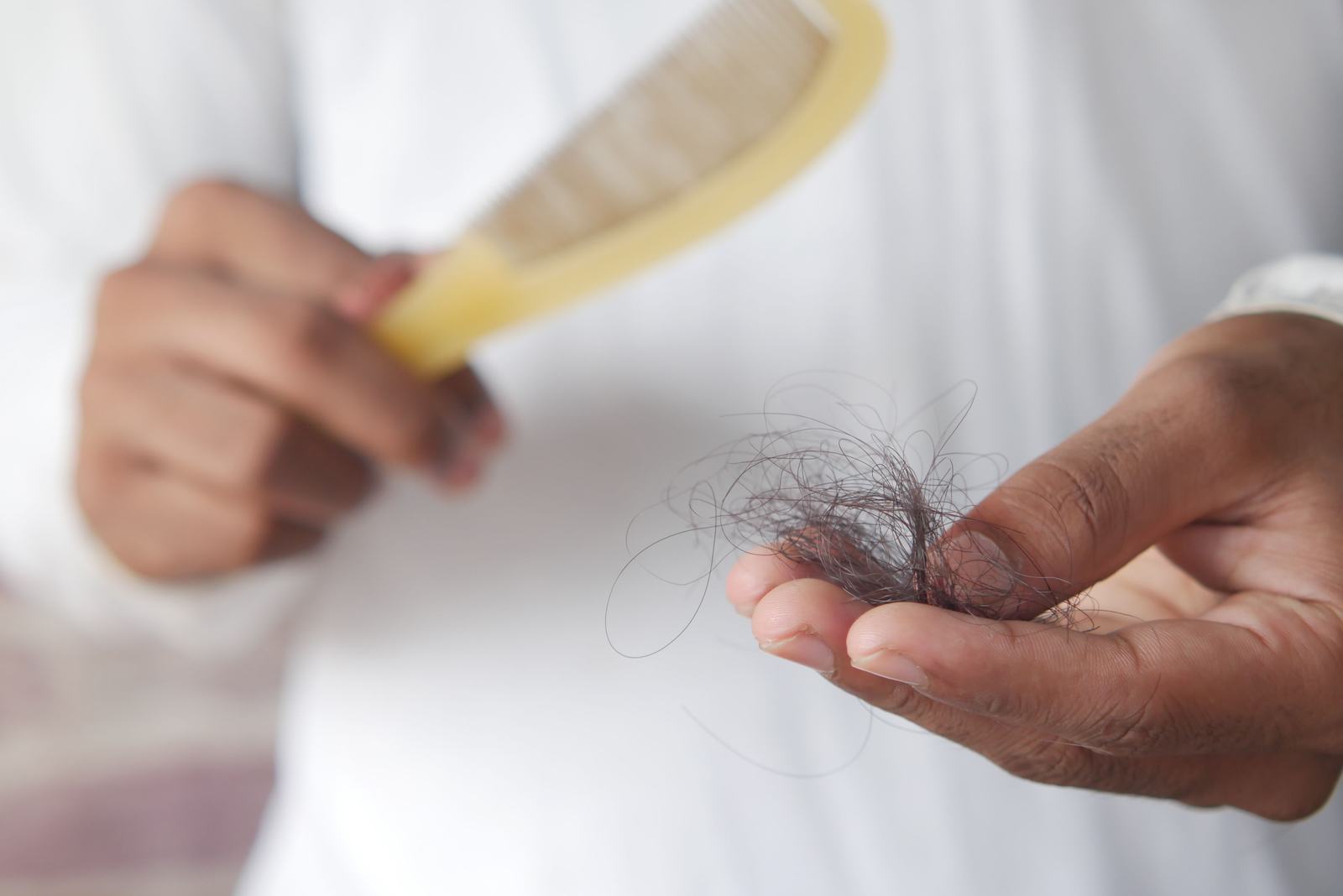 Hand holding a clump of shed hair, illustrating hair loss