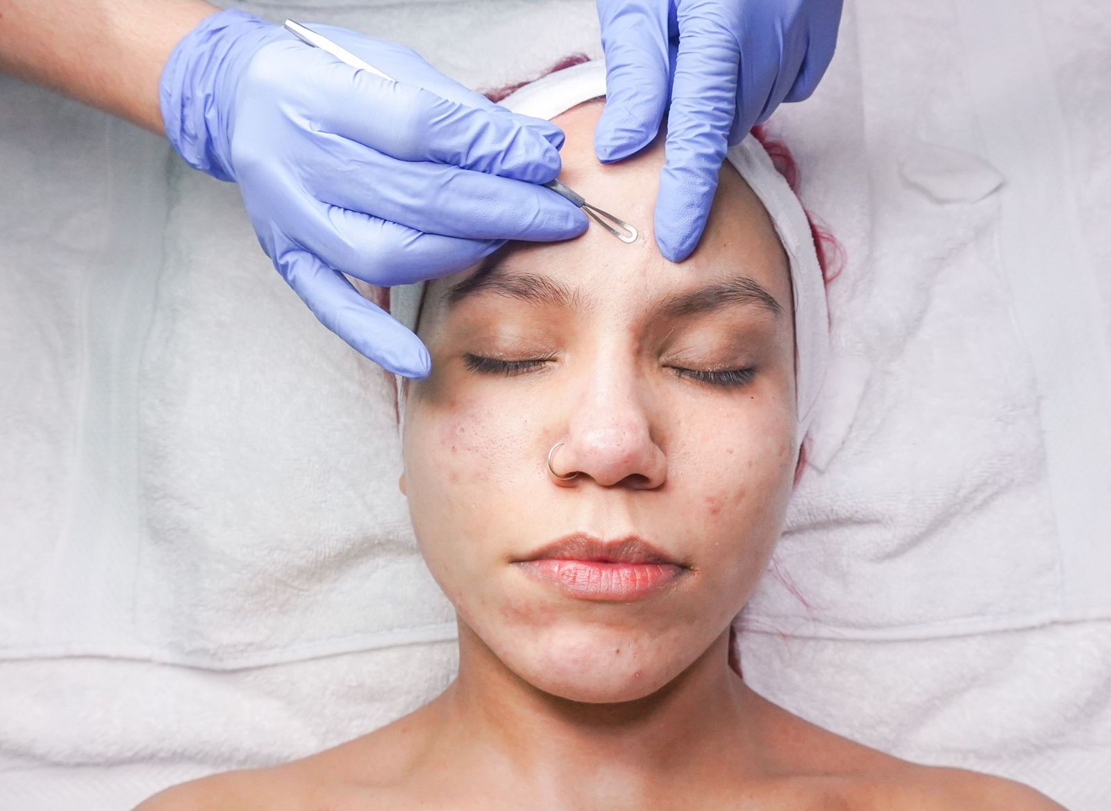 Aesthetician performing a precise dermaplaning treatment on a relaxed guest