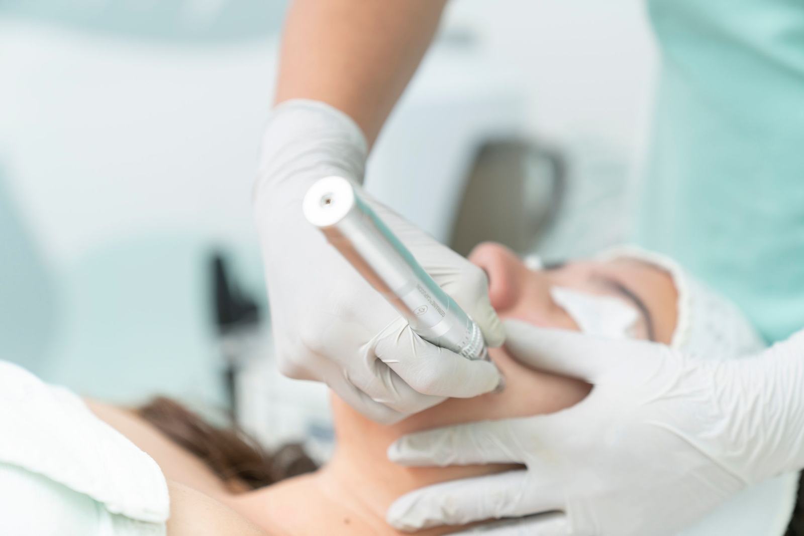 Close up of a microneedling pen being used during a facial treatment