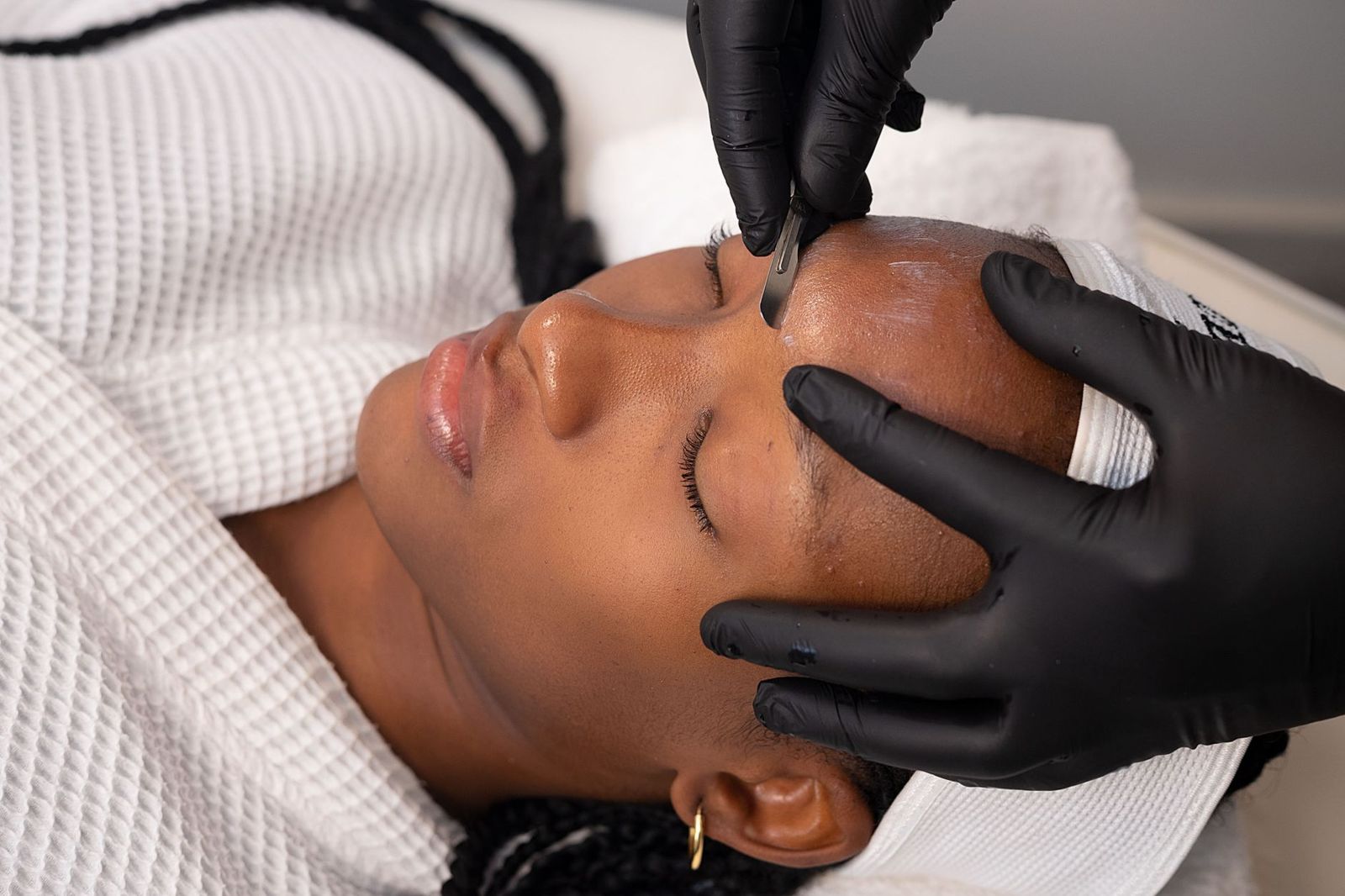 A gloved provider holding a small blade near a client's forehead during a facial skin treatment